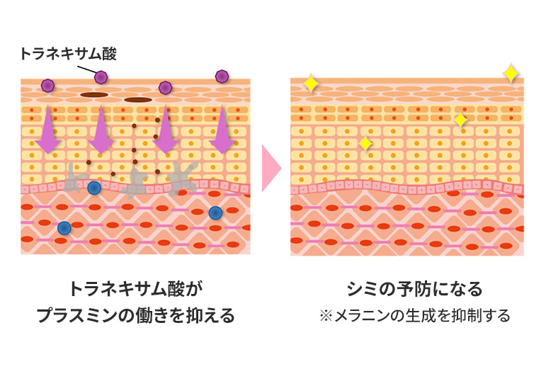 トラネキサム酸